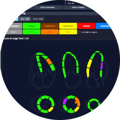 CH Cardiology Echo - application screen